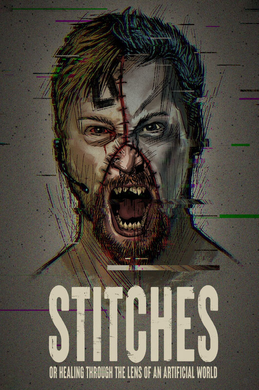 Stitches